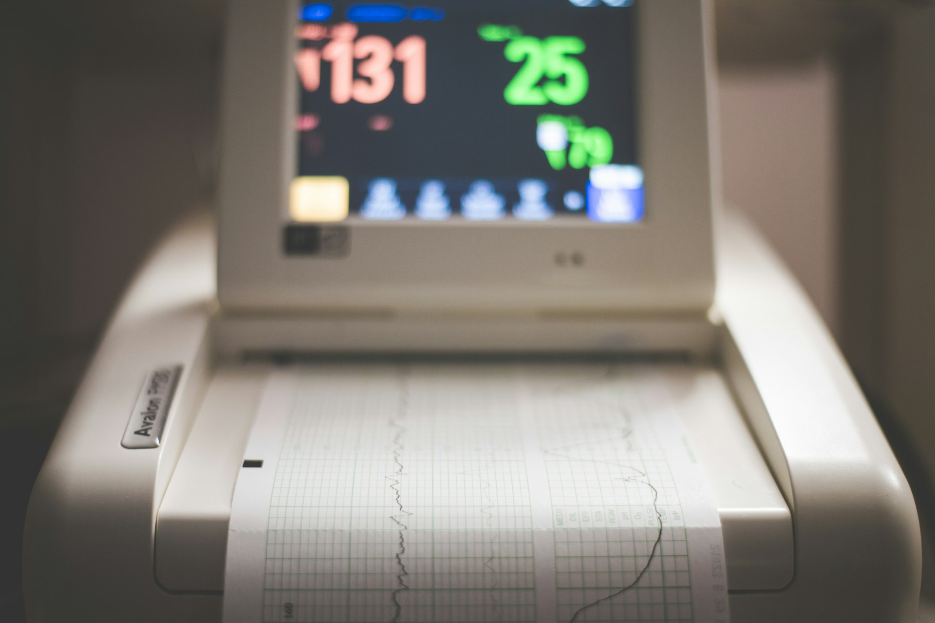 Fetal monitor recording a CTG trace on paper